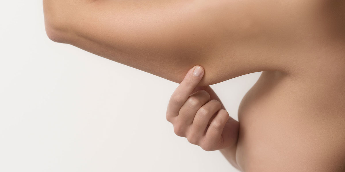 brachioplastie