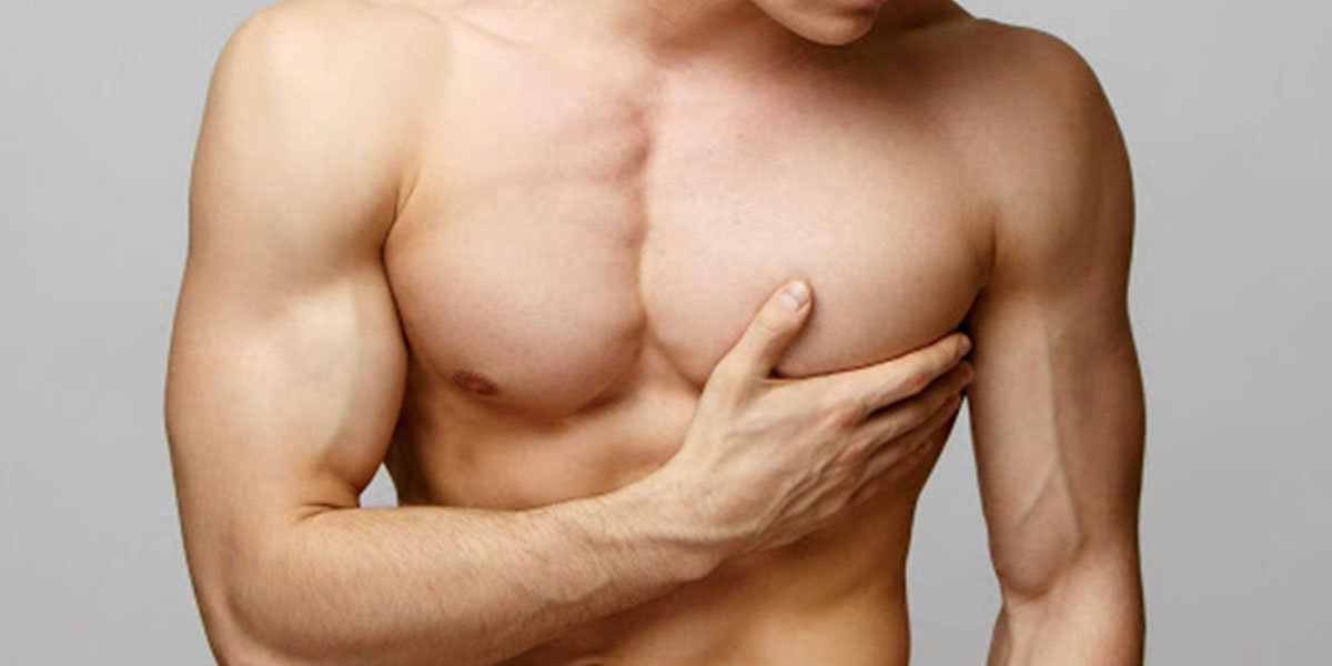 gynecomastie
