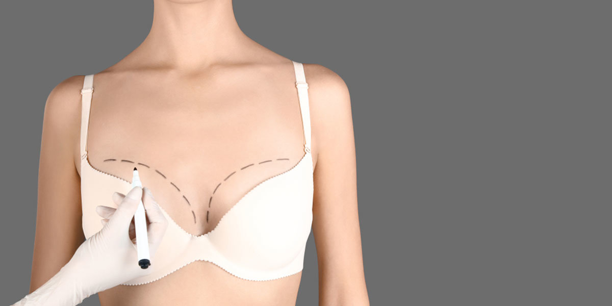redrapage-mammaire-implant